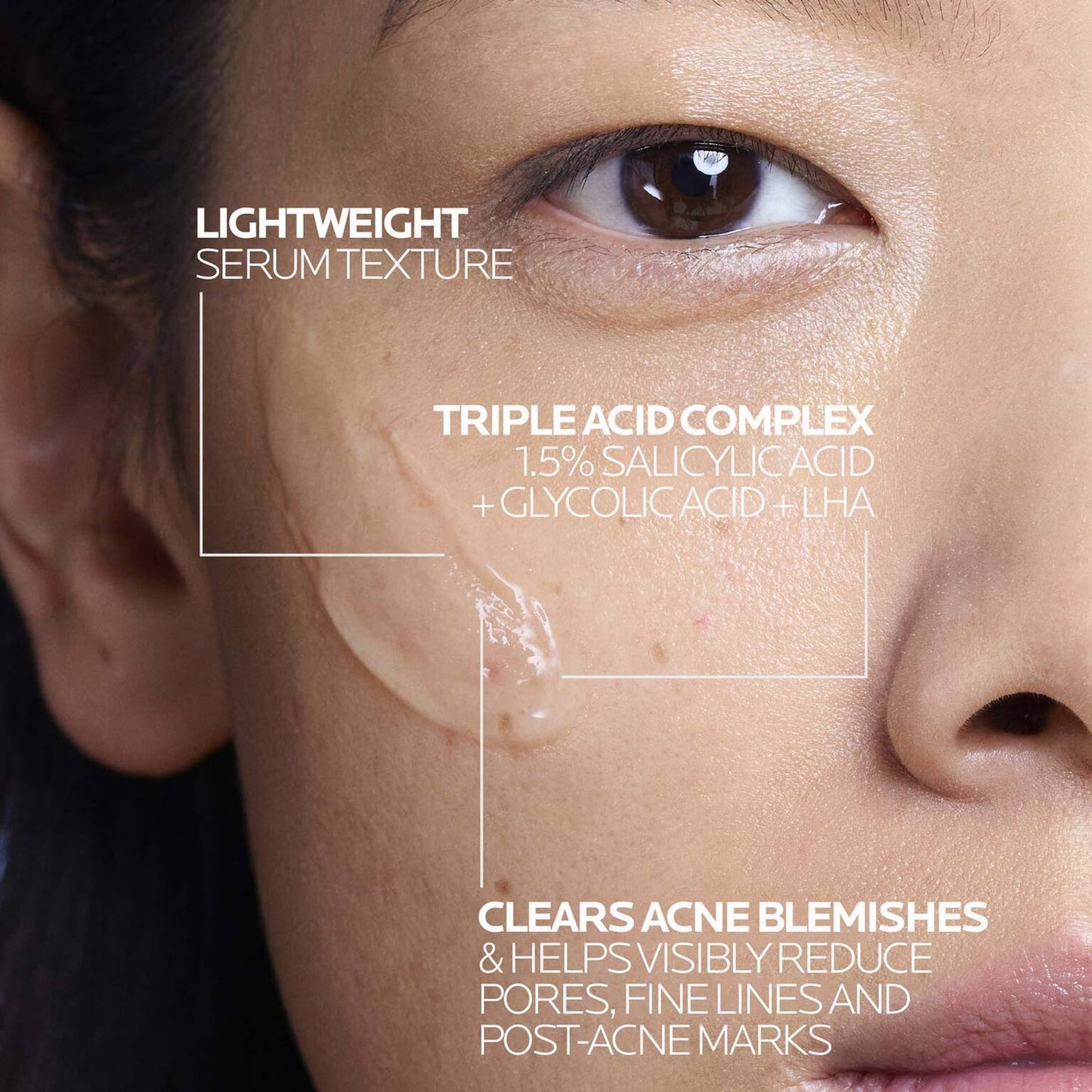 effaclar-salicylic-acid-acne-treatment-serum-y9 LaRochePosay-Product-Effaclar-Effaclar-Serum-30ml-3337875722827-Texture-REV.jpg