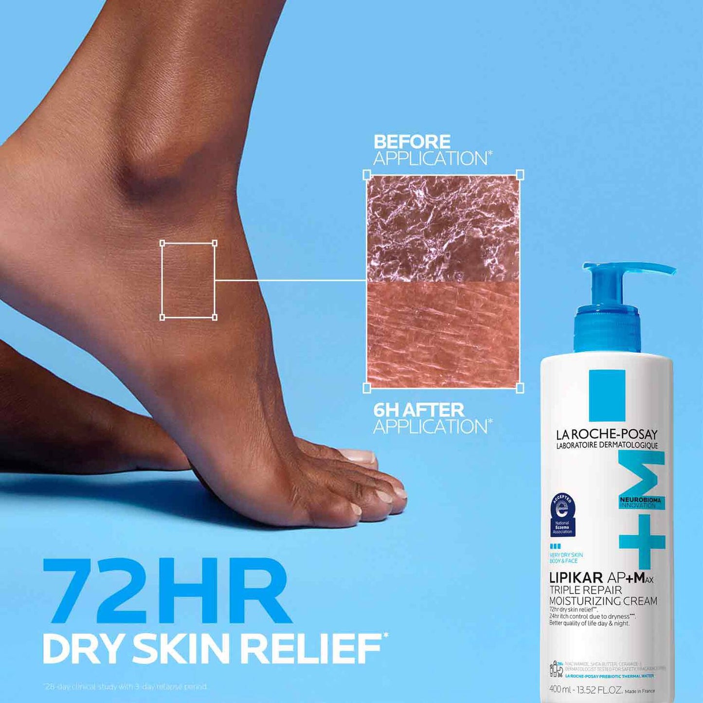 lipikar-ap-max-triple-repair-moisturizing-cream-b2 LaRochePosay-Product-Skincare-Lipikar-Balm-AP+MAX-400ml-3337875941150-ATF-PIM-BeforeAfter.jpg