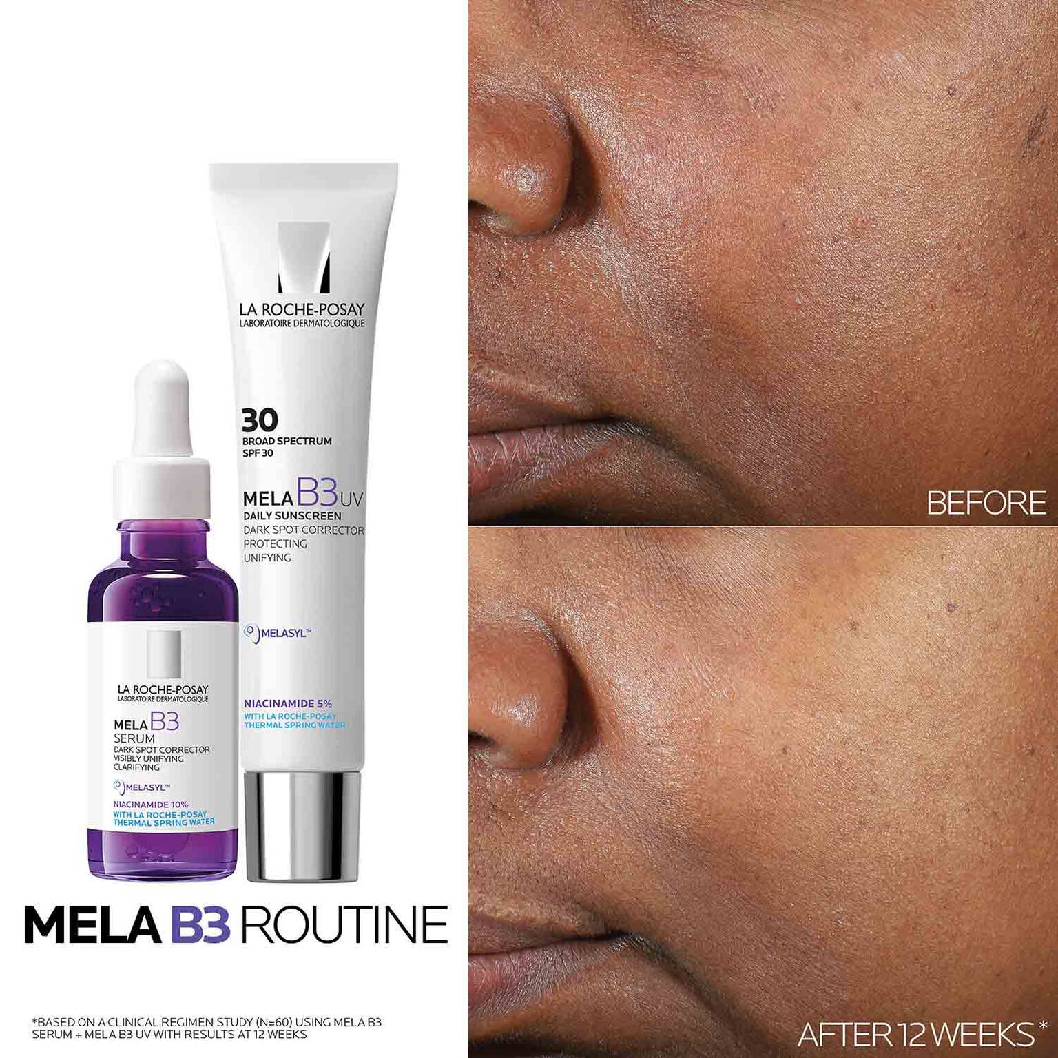 mela-b3-dark-spot-serum-with-melasyltm-niacinamide-v2 Mela-B3-routine_1500X1500.jpg