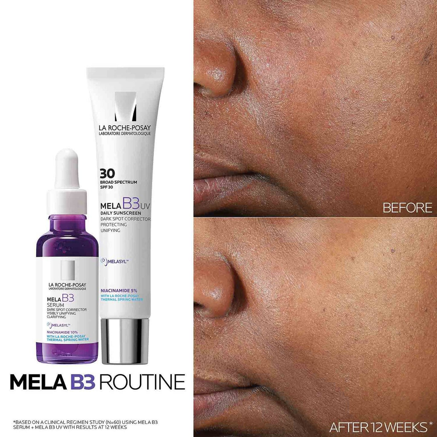 mela-b3-uv-daily-moisturizer-spf-30-with-melasyltm-niacinamide-y8 Mela-B3-routine_1500X1500.jpg