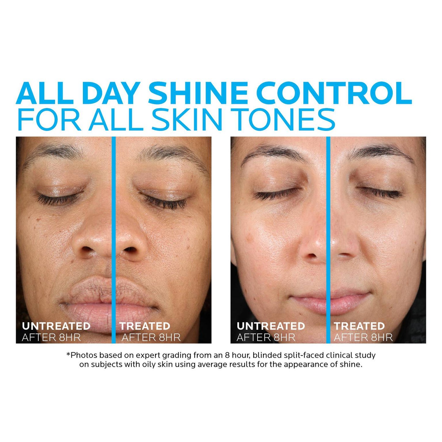 toleriane-double-repair-matte-face-moisturizer-for-oily-skin-b5 la-roche-posay-toleriane-matte-moisturizer-before-and-after-pdp-alt.jpg